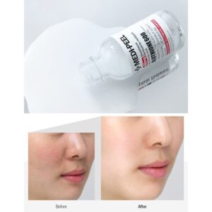 phản hồi của khách hàng khi sử dụng serum medi peel