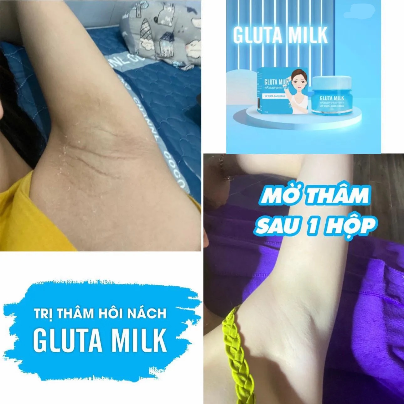 Kem trị thâm nách Gluta Milk