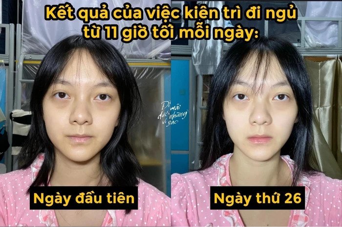 Giấc ngủ và làn da đẹp nhiều người bỏ qua